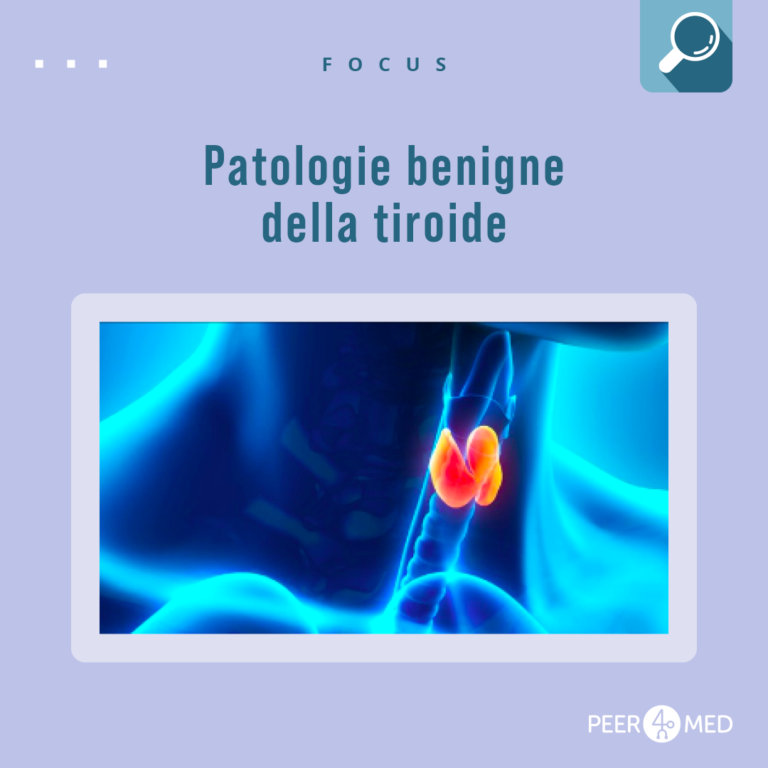 Cosa Sapere Sulle Patologie Benigne Della Tiroide - Peer4Med