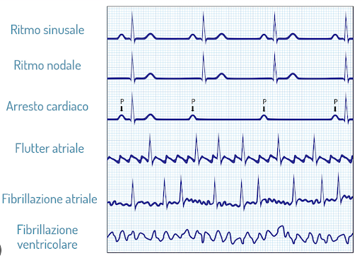analisi ritmo cardiaco